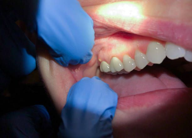 Best Emergency Dental Care for Trauma or Injury in Bells, TX