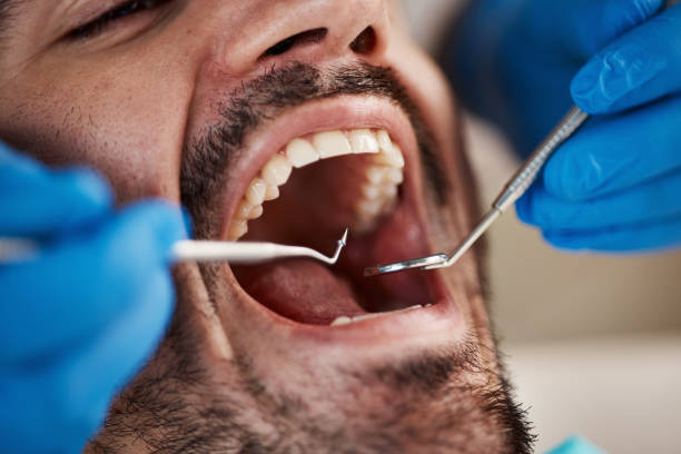 Best Emergency Dental Surgery in Bells, TX
